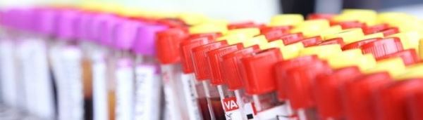 В РФ к диагностике коронавируса подключились 250 лабораторий